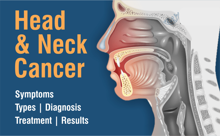 Head and Neck Cancer Symptoms, Types and Treatment
