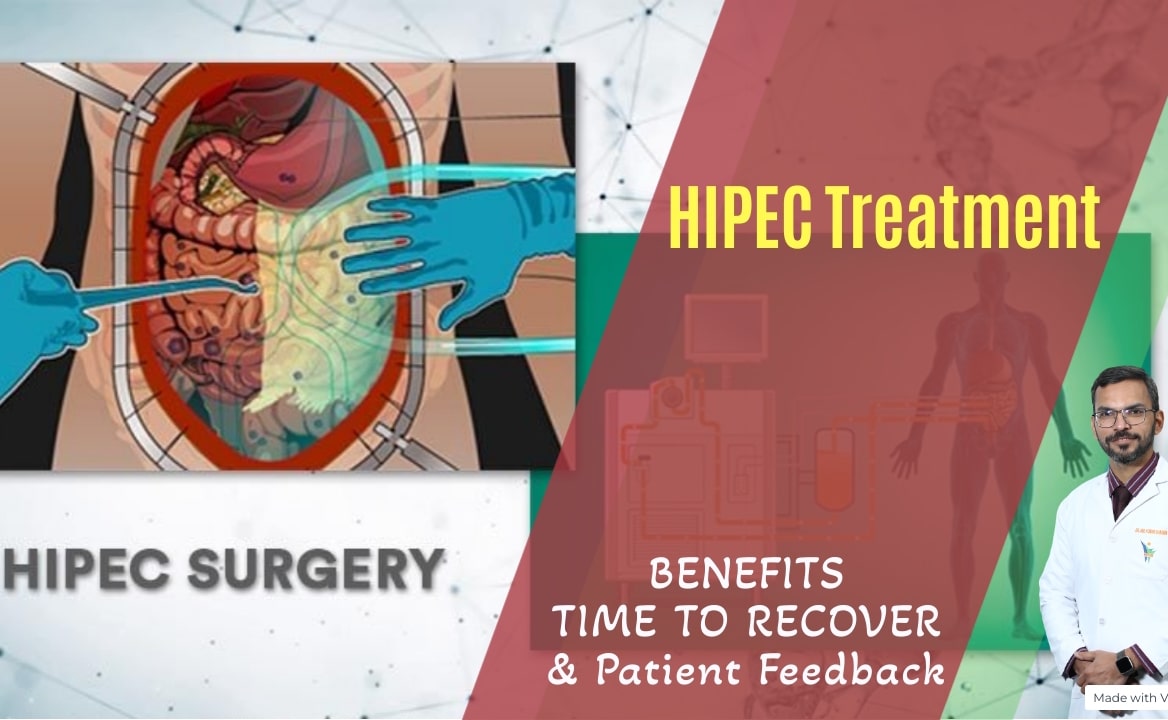 HIPEC TREATMENT FOR CANCER IN CHANDIGARH